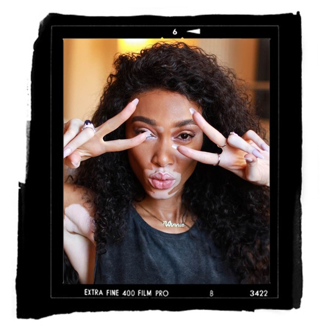 ESC: Winnie Harlow, Met Gala Diary